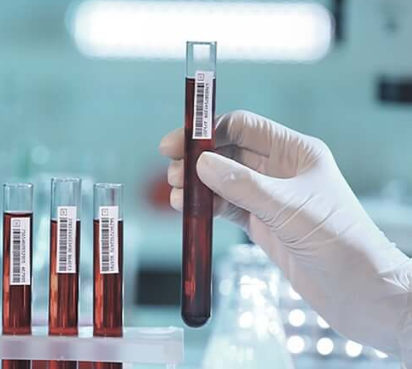 test tube barcode label